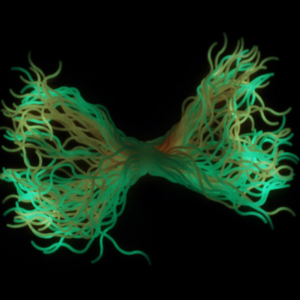 FIDGET SPAGHETTI GLOW